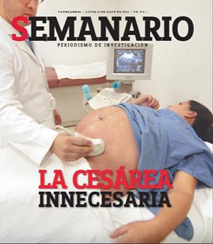 La cesárea innecesaria